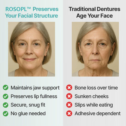 🌎Ends Today: 70% OFF!    Custom-Fit Full Functional DenturesMake you more confident✨