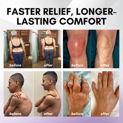 Eettsy™ Turmeric & Emu Oil Arthritis Soothing Pain Relief Massage Gel 👨‍⚕️Australian Osteopathic Association （AOA）Approved
