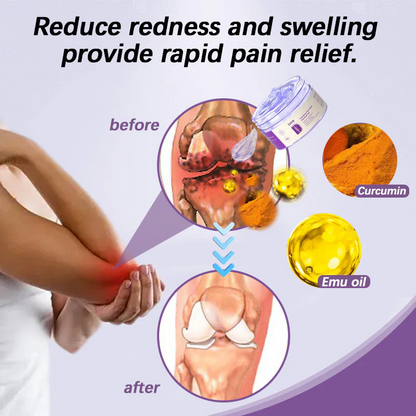 Eettsy™ Turmeric & Emu Oil Arthritis Soothing Pain Relief Massage Gel 👨‍⚕️Australian Osteopathic Association （AOA）Approved