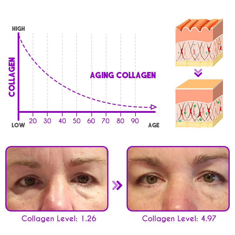 👀DEleventh Pro-Xylane Active Eye Cream🤩😍💃🏼