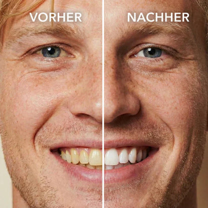 EETTSY™ Tooth Whitening - Instant Clean Smile