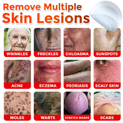 MicroNeedle Botanic Skin Tag Removal Patch