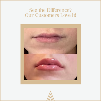 Kehyla Beauty - Lip Plumper